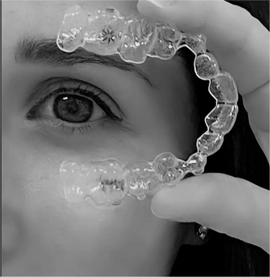 Ortod&ograve;ncia i Invisalign a Girona