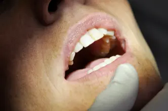 Est&egrave;tica dental