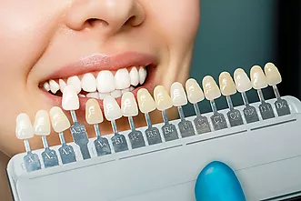 Blanquejament dental - Quan et pot ajudar l’estètica i la higiene bucodental?