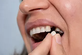 Implants dentals - Quan et poden ajudar els implants i les pròtesis?